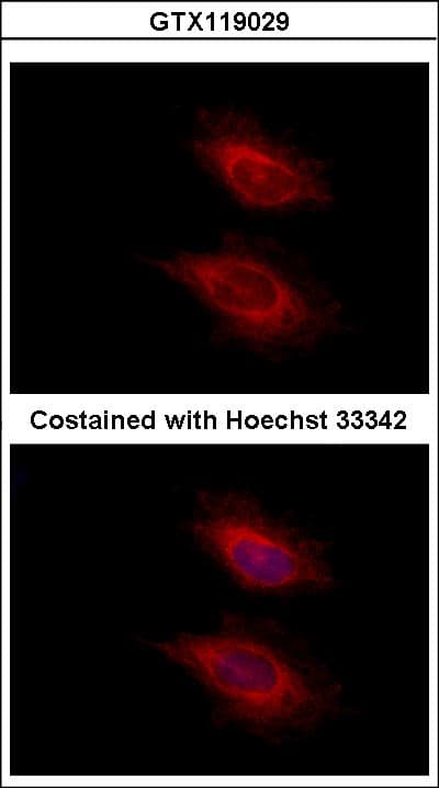 YARS2 Antibody