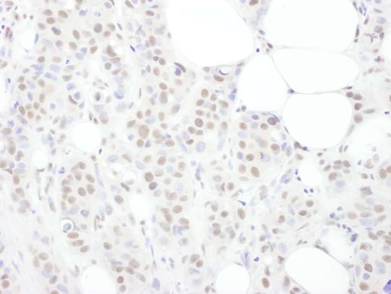 TDP-43 / TARDBP Antibody (aa250-300)