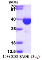 Human PECR Protein (Recombinant His)