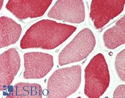 IHC-plus™ TPM4 Antibody (aa26-54)