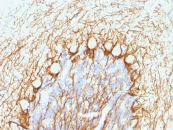 NEFH / NF-H Antibody (clone NE14, Ready-to-Use)
