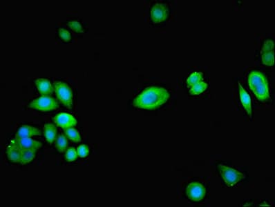 IHC-plus™ NPHP1 / Nephronophthisis Antibody
