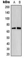 ER Alpha / Estrogen Receptor Antibody (phospho-Ser118)