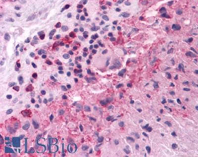 PathPlus™ GRM3 / MGLUR3 Antibody (N-Terminus)