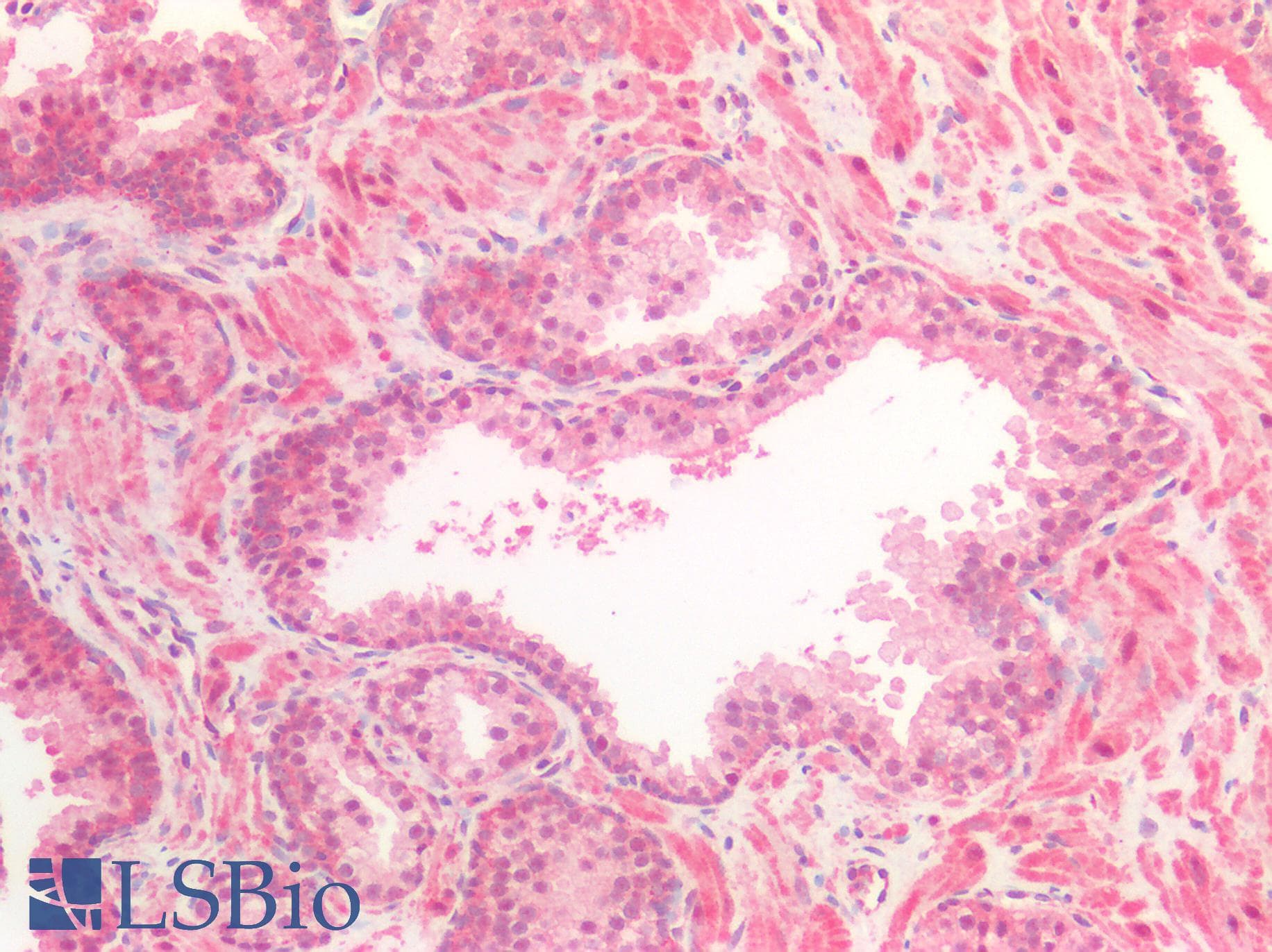 IHC-plus™ ALK2 / ACVR1 Antibody (aa20-125)