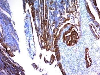 Mucin 2 / MUC2 Antibody (clone MUCN2-1)