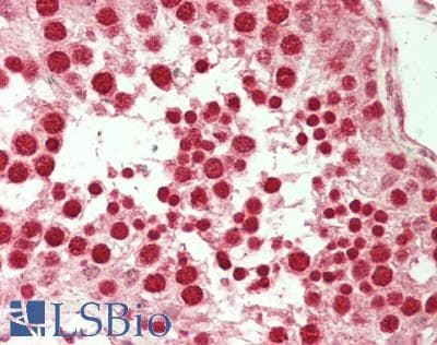 IHC-plus™ H2AFX / H2AX Antibody (aa 12-141)