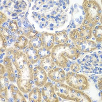 Polyclonal Rabbit anti-Human GNAI2 Antibody (IHC)