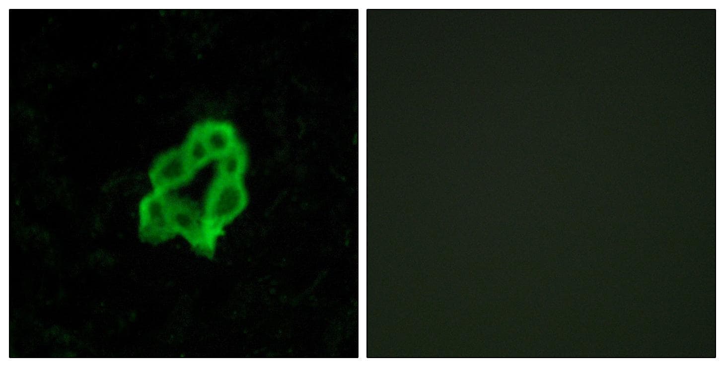 ADGRB1 / BAI1 Antibody