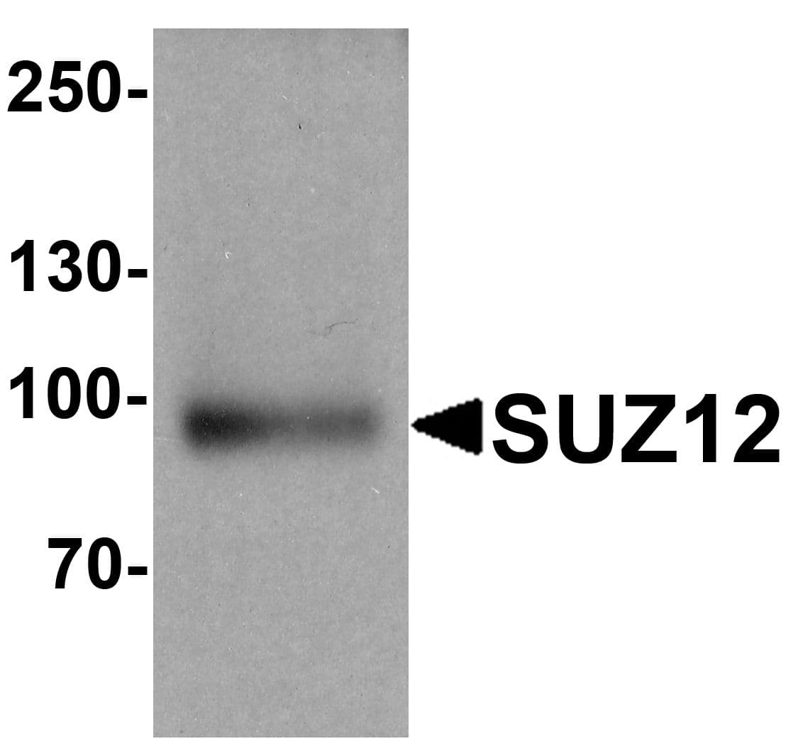 IHC-plus™ Polyclonal Rabbit anti-Human SUZ12 Antibody (IHC, IF, WB)