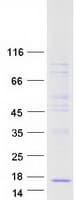 Human CLPS / Colipase Protein (Recombinant Myc-DDK (Flag))