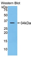 LOXL4 / LOXC Antibody (aa479-756)