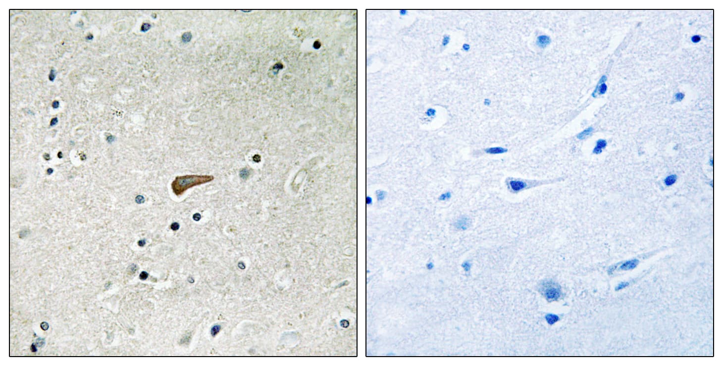 FRS2 Antibody (phospho-Tyr436)