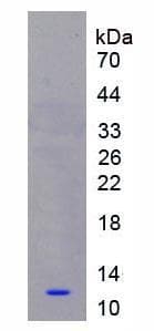 Human S100A8 / MRP8 Protein (Recombinant His)