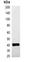 GST Tag Antibody