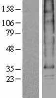 Human SLC35B1 / UGTREL1 Protein (Over-Expression Lysate Myc-DDK (Flag))