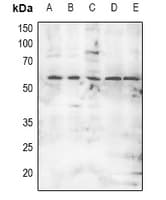 MKNK2 / MNK2 Antibody