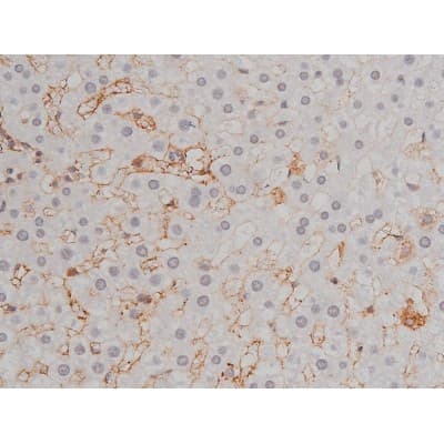 Polyclonal Rabbit anti-Human LYN Antibody (phospho-Tyr508, IHC, IF, WB)