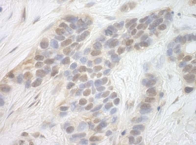 CDK8 Antibody (aa420-470)