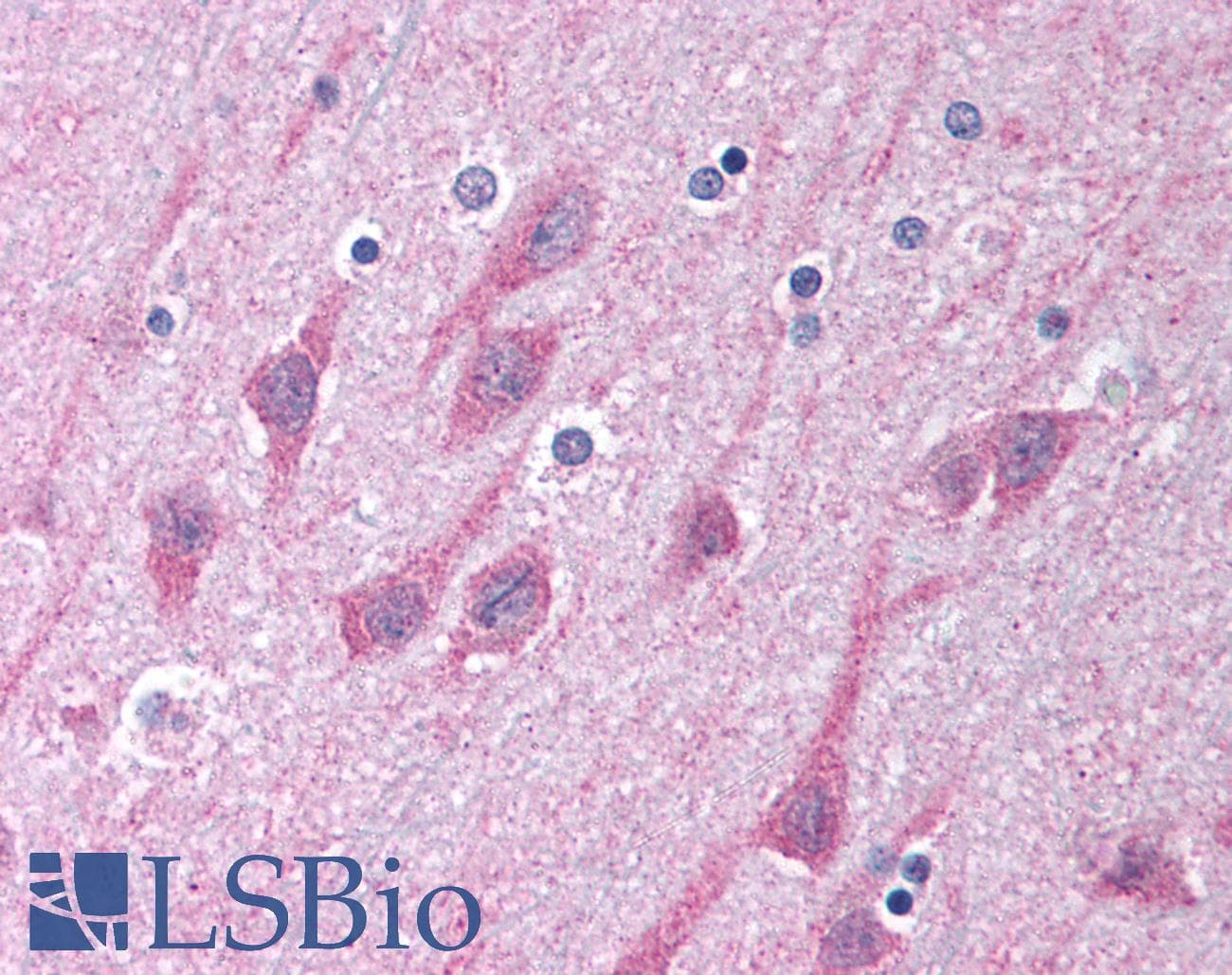 IHC-plus™ Polyclonal Rabbit anti-Human TICAM1 / TRIF Antibody (IHC, IF, WB)