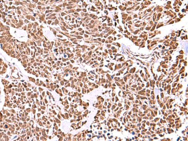 RCOR3 Antibody