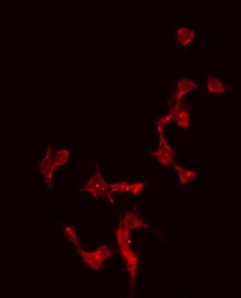 Polyclonal Rabbit anti-Human CBLN4 / Cerebellin 4 Antibody (IHC, IF, WB)