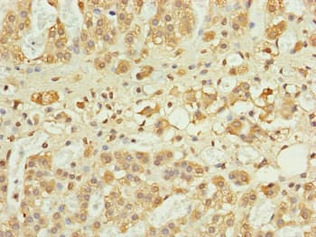 RPP25L / C9orf23 Antibody