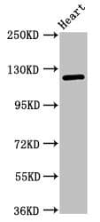 SEMA5B / Semaphorin 5B Antibody
