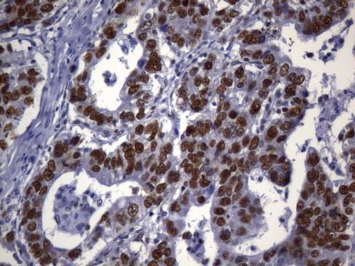 Monoclonal Mouse anti-Human MSH2 Antibody (clone UMAB259, Carrier-free, aa1-304, IHC)