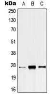 ANP32C Antibody (Internal)