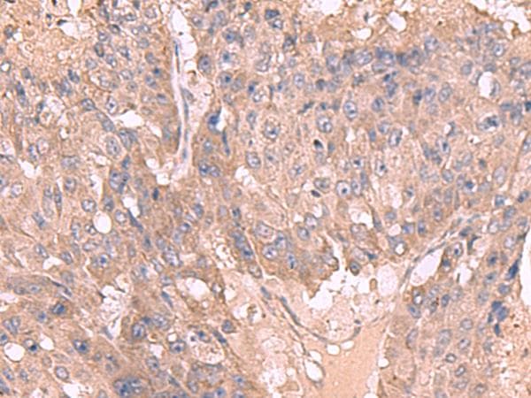 MAGEC2 / CT10 Antibody