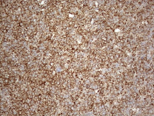 VAP33 / VAPA Antibody (aa2-227, clone OTI10E10)