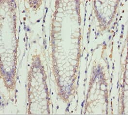 Polyclonal Rabbit anti-Human SPFH2 / ERLIN2 Antibody (IHC, WB)