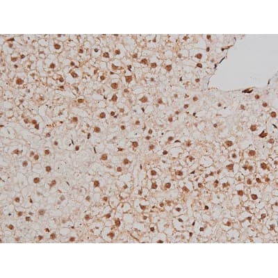Polyclonal Rabbit anti-Human FLNA / Filamin A Antibody (phospho-Ser2152, IHC, IF, WB)