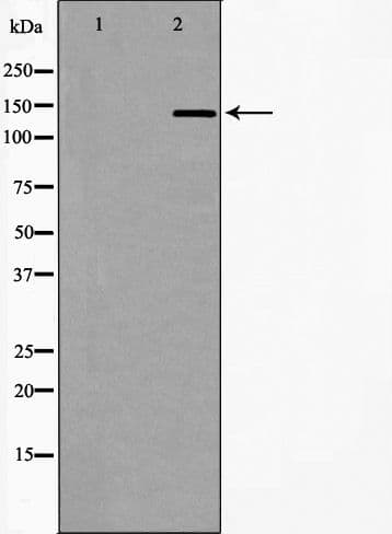 DCTN1 / Dynactin 1 Antibody