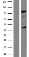 KDM7A / JHDM1D Protein (Over-Expression Lysate Myc-DDK (Flag))