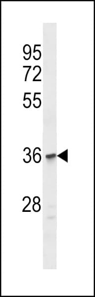 OR1C1 Antibody (aa278-303)