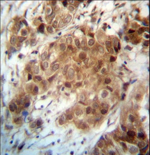 Polyclonal Rabbit anti-Human FOXO3 / FOXO3A Antibody (aa1-30, IHC, WB)