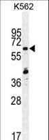 Polyclonal Rabbit anti-Human ZNF619 Antibody (aa114-143, WB)