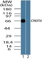 IHC-plus™ Polyclonal Rabbit anti-Human CNOT4 / CLONE243 Antibody (aa50-100, IHC, WB)