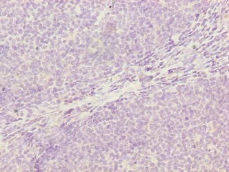 Polyclonal Rabbit anti-Human OXSM / KS Antibody (IHC)