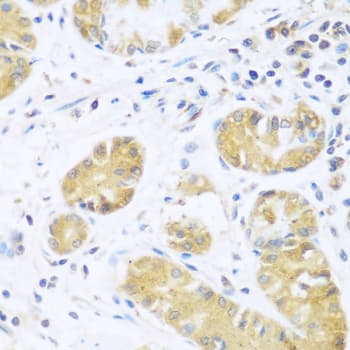 UCHL3 Antibody