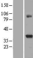 KCNAB2 / Kv-Beta-2 Protein (Over-Expression Lysate Myc-DDK (Flag))