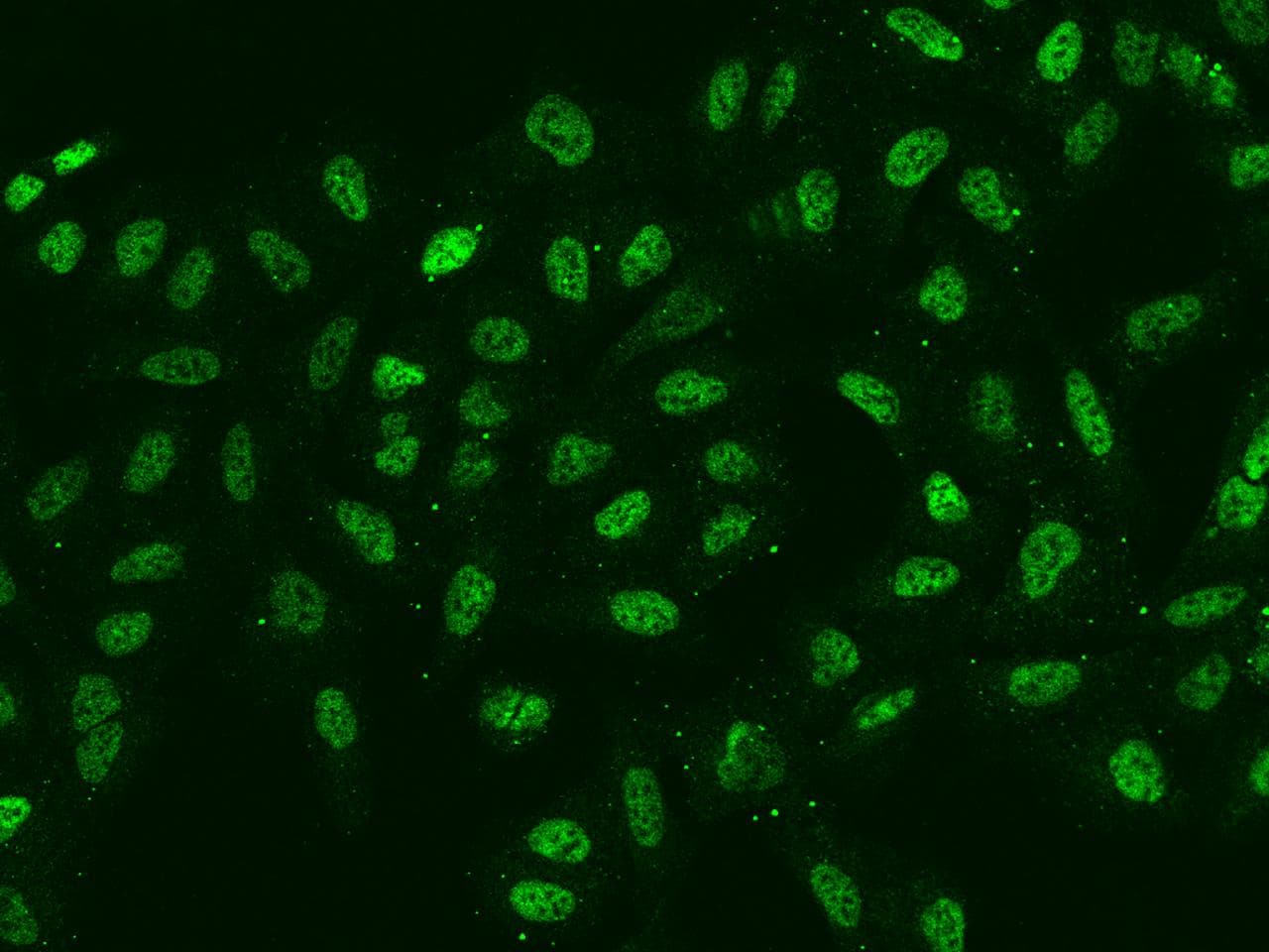 Polyclonal Rabbit anti-Human SIX4 Antibody (IHC, IF)