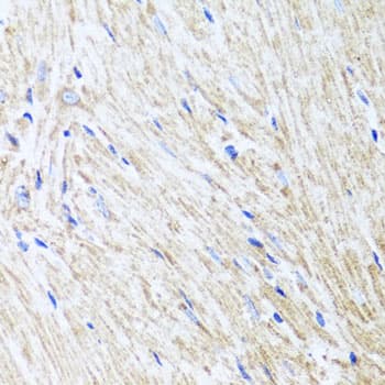 Polyclonal Rabbit anti-Human L2HGDH Antibody (IHC, WB)