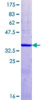 Human FKRP Protein (Recombinant GST, N-terminus)