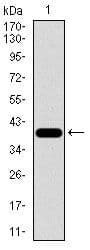 Monoclonal Mouse anti-Human RPL18A Antibody (clone 6G6G10, Amino Acid: 50-176, IHC, IF, WB)