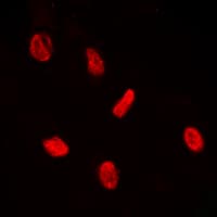 ERF / PE2 Antibody (C-Terminus)