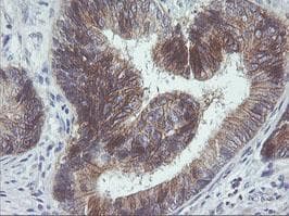 ERBB2 / HER2 Antibody (aa676-1255, clone OTI1A12, Carrier-free)