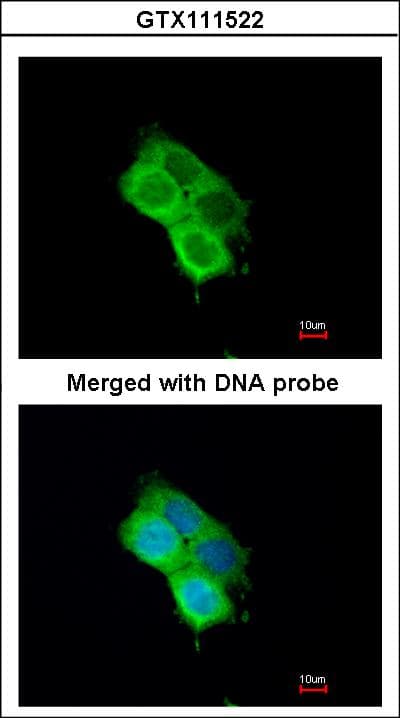 Polyclonal Rabbit anti-Human OXSR1 / OSR1 Antibody (aa1-281, WB)